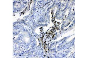 IHC analysis of Prothrombin  using anti-Prothrombin  antibody . (Prothrombin 抗体  (AA 67-124))