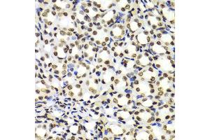 Immunohistochemistry (Paraffin-embedded Sections) (IHC (p)) image for anti-Histone 3 (H3) (H3K4me) antibody (ABIN3023251)
