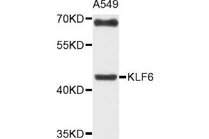 Western blot analysis of extracts of A549 cells, using KLF6 antibody. (KLF6 抗体)