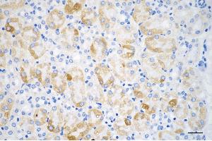 Immunohistochemistry was performed on paraffin-embedded mouse kidney using ACSL4 antibody (ABIN7797498), 1:200).