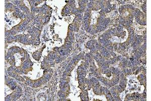IHC analysis of ATP5F1B using anti-ATP5F1B antibody (ABIN7599866). (Atp5f1b (AA 123-529) 抗体)