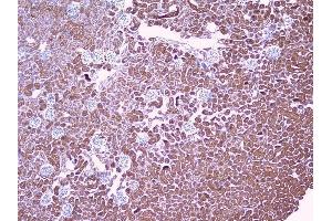IHC analysis of PBP using anti-PBP antibody (ABIN5693043). (PEBP1 抗体)
