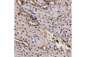 Immunohistochemistry (IHC) image for anti-Butyrylcholinesterase (BCHE) antibody (ABIN1871242) (Butyrylcholinesterase 抗体)