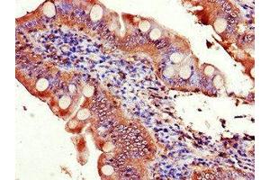 Immunohistochemistry of paraffin-embedded human small intestine tissue using ABIN7152149 at dilution of 1:100 (EIF3C 抗体  (AA 201-500))