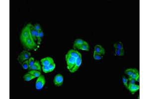 Immunofluorescent analysis of MCF-7 cells using ABIN7163072 at dilution of 1:100 and Alexa Fluor 488-congugated AffiniPure Goat Anti-Rabbit IgG(H+L) (Phenylalanyl-tRNA Synthetase, alpha Subunit (FARSA) (AA 2-508) 抗体)