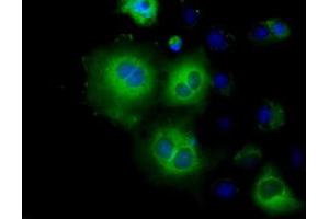 Image no. 6 for anti-Hexokinase 2 (HK2) antibody (ABIN1498647)