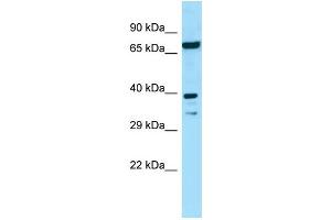 WB Suggested Anti-EIF2B2 Antibody Titration: 1. (EIF2B2 抗体  (N-Term))