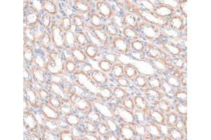 Immunohistochemistry of paraffin-embedded Mouse kidney using PDGFD Polyclonal Antibody at dilution of 1:100 (40x lens). (PDGFD 抗体)
