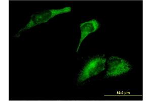 Immunofluorescence of monoclonal antibody to ARL8A on HeLa cell. (ARL8A 抗体  (AA 1-186))