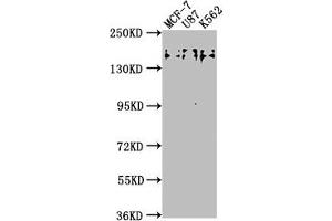 Western Blot Positive WB detected in: MCF-7 whole cell lysate, U87 whole cell lysate, K562 whole cell lysate All lanes: TJP2 antibody at 1:2000 Secondary Goat polyclonal to rabbit IgG at 1/50000 dilution Predicted band size: 134, 118, 112, 132, 116, 131, 138 kDa Observed band size: 150 kDa (TJP2 抗体  (AA 1165-1183))