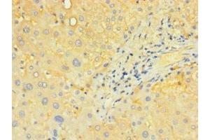 Immunohistochemistry of paraffin-embedded human liver tissue using ABIN7170195 at dilution of 1:100 (SLC25A4 抗体  (AA 40-102))