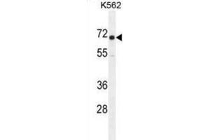 Western Blotting (WB) image for anti-Insulin-Like Growth Factor 2 mRNA Binding Protein 1 (IGF2BP1) antibody (ABIN2995660)