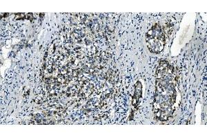 IHC analysis of TMBIM1 using anti-TMBIM1 antibody (ABIN7603190). (TMBIM1 抗体  (N-Term))