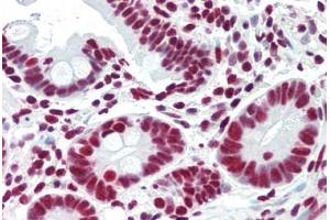 Human Small Intestine (formalin-fixed, paraffin-embedded) stained with ACIN1 antibody ABIN461879 at 5 ug/ml followed by biotinylated goat anti-rabbit IgG secondary antibody ABIN481713, alkaline phosphatase-streptavidin and chromogen. (ACIN1 抗体)