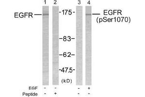 Image no. 2 for anti-Epidermal Growth Factor Receptor (EGFR) (pSer1070) antibody (ABIN196758) (EGFR 抗体  (pSer1070))