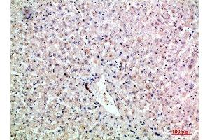 Immunohistochemical analysis of paraffin-embedded human-liver, antibody was diluted at 1:200 (LTB 抗体  (AA 41-90))