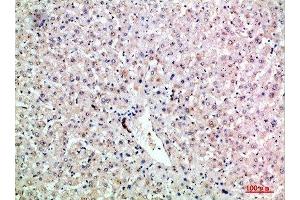 Immunohistochemical analysis of paraffin-embedded human-liver, antibody was diluted at 1:200 (LTB 抗体  (AA 41-90))