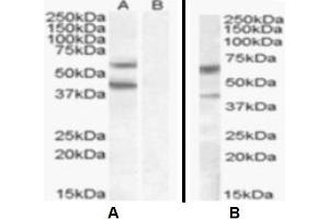 Western Blotting (WB) image for anti-Diacylglycerol O-Acyltransferase 2 (DGAT2) (Internal Region) antibody (ABIN2465597) (DGAT2 抗体  (Internal Region))