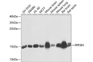 Western blot analysis of extracts of various cell lines using PPP3R1 Polyclonal Antibody at dilution of 1:1000. (PPP3R1 抗体)