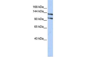 Western Blotting (WB) image for anti-RNA Binding Motif Protein 5 (RBM5) antibody (ABIN2458330) (RBM5 抗体)