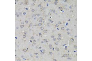 Immunohistochemistry of paraffin-embedded rat brain using AMPD1 antibody (ABIN5995393) (40x lens). (AMPD1 抗体)