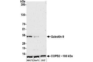 Western Blotting (WB) image for anti-Lectin, Galactoside-Binding, Soluble, 9 (LGALS9) (AA 305-355) antibody (ABIN7449427)