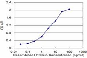 Detection limit for recombinant GST tagged ENTPD4 is approximately 0. (ENTPD4 抗体  (AA 371-469))
