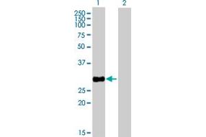 Western Blot analysis of HSD17B8 expression in transfected 293T cell line by HSD17B8 MaxPab polyclonal antibody. (HSD17B8 抗体  (AA 1-261))