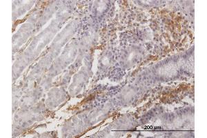 Immunoperoxidase of purified MaxPab antibody to AOC3 on formalin-fixed paraffin-embedded human stomach.