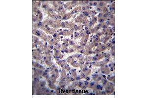 PTGR2 Antibody (N-term) (ABIN656796 and ABIN2846015) immunohistochemistry analysis in formalin fixed and paraffin embedded human liver tissue followed by peroxidase conjugation of the secondary antibody and DAB staining.