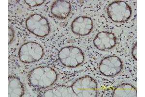 Immunoperoxidase of monoclonal antibody to TLK2 on formalin-fixed paraffin-embedded human colon tissue. (TLK2 抗体  (AA 1-126))