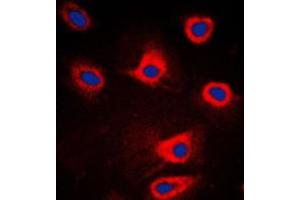 Immunofluorescent analysis of PERK staining in HeLa cells. (PERK 抗体  (N-Term))