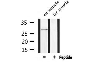 Western blot analysis of extracts from rat muscle, using MPZ Antibody. (MPZ 抗体  (C-Term))
