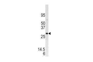 Western blot analysis of anti-DUSP3 Pab (ABIN392924 and ABIN2842297) in SK-BR-3 cell line lysate. (Dual Specificity Phosphatase 3 (DUSP3) (AA 1-30), (N-Term) 抗体)