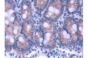 DAB staining on IHC-P; Samples: Rat Small intestine Tissue (ATP5B 抗体  (AA 47-529))