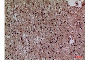 Immunohistochemistry (IHC) analysis of paraffin-embedded Human Brain, antibody was diluted at 1:100. (CDK4 抗体  (N-Term))