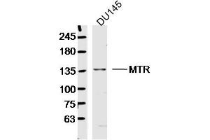 DU145 lysates probed with MTR Polyclonal Antibody, Unconjugated  at 1:300 dilution and 4˚C overnight incubation. (MTR 抗体  (AA 1001-1100))