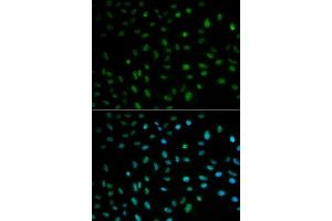 Immunofluorescence analysis of MCF-7 cells using ELAVL1 antibody. (ELAVL1 抗体)
