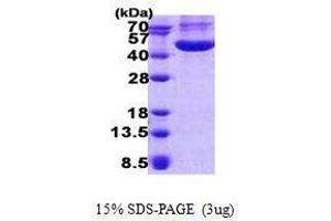 Figure annotation denotes ug of protein loaded and % gel used. (CHI3L1 蛋白)