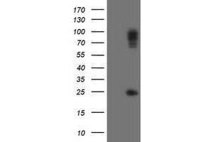 Image no. 1 for anti-Spastic Paraplegia 7 (SPG7) (AA 300-573) antibody (ABIN1491370) (SPG7 抗体  (AA 300-573))