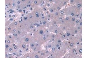 Detection of CTTN in Mouse Liver Tissue using Polyclonal Antibody to Cortactin (CTTN) (Cortactin 抗体  (AA 1-509))
