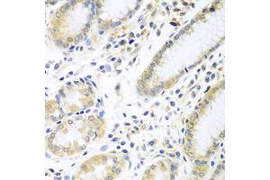 Immunohistochemistry of paraffin-embedded human stomach using IL5 antibody (ABIN5975164) at dilution of 1/100 (40x lens).