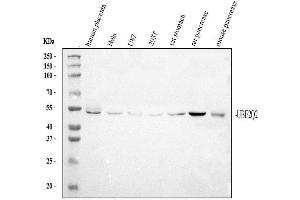 Western blot analysis of UBE2Q2 using anti-UBE2Q2 antibody (ABIN3043953).