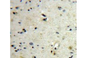 #VALUE! (CGB 抗体  (AA 31-165))
