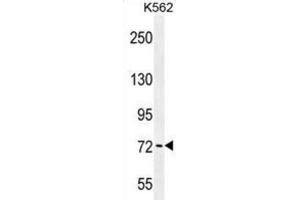 Western Blotting (WB) image for anti-P21-Activated Kinase 6 (PAK6) antibody (ABIN2996561) (PAK6 抗体)
