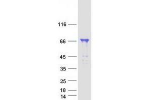 WRNIP1 Protein (Transcript Variant 2) (Myc-DYKDDDDK Tag)