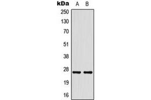 Western blot analysis of HSP27 expression in HeLa (A), HepG2 (B) whole cell lysates. (HSP27 抗体  (Center))