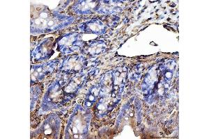 IHC analysis of Annexin VI/ANXA6 using anti-Annexin VI/ANXA6 antibody (ABIN5692982).
