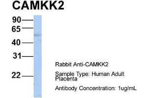 Host: Rabbit  Target Name: CAMKK2  Sample Tissue: Human Adult Placenta  Antibody Dilution: 1. (CAMKK2 抗体  (N-Term))