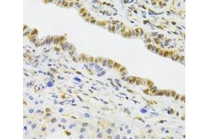 Immunohistochemistry of paraffin-embedded Rat liver using EFTUD2 Polyclonal Antibody at dilution of 1:100 (40x lens). (EFTUD2 抗体)